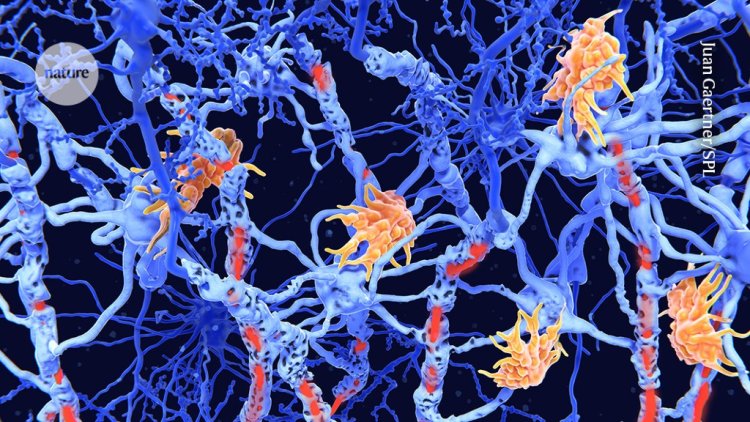 CAR-T therapy for multiple sclerosis enters US trials for first time