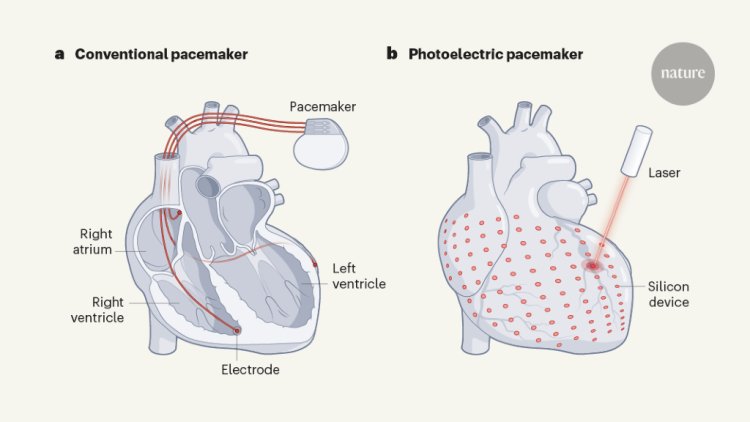 Light can restore a heart’s rhythm