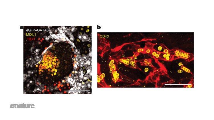 A human embryo model mimics early development and blood-cell formation