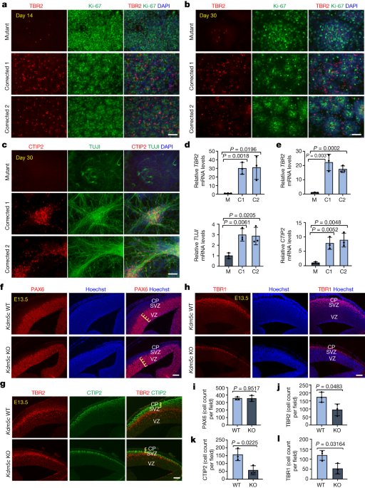 WNT signalling control by KDM5C during development affects cognition