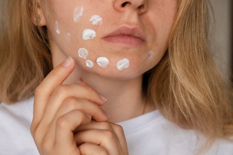 Carcinogen Benzene Can Form in Some Acne Treatments: Report